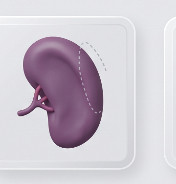 Esplenectomia